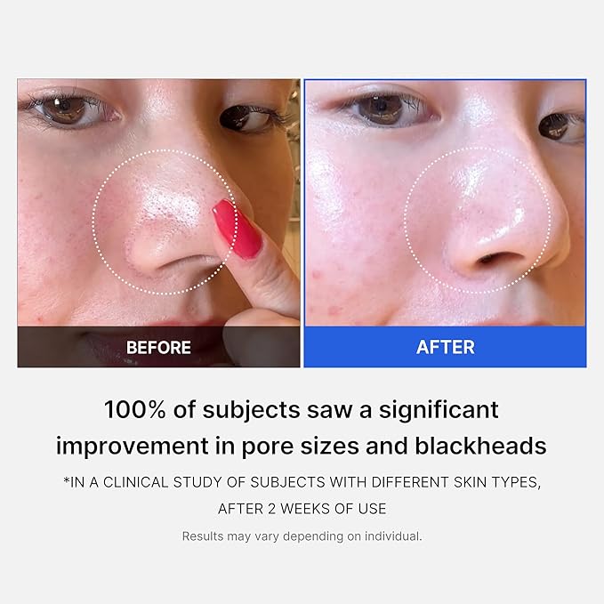 Medicube - Zero Pore Pad 2.0 (70pcs)