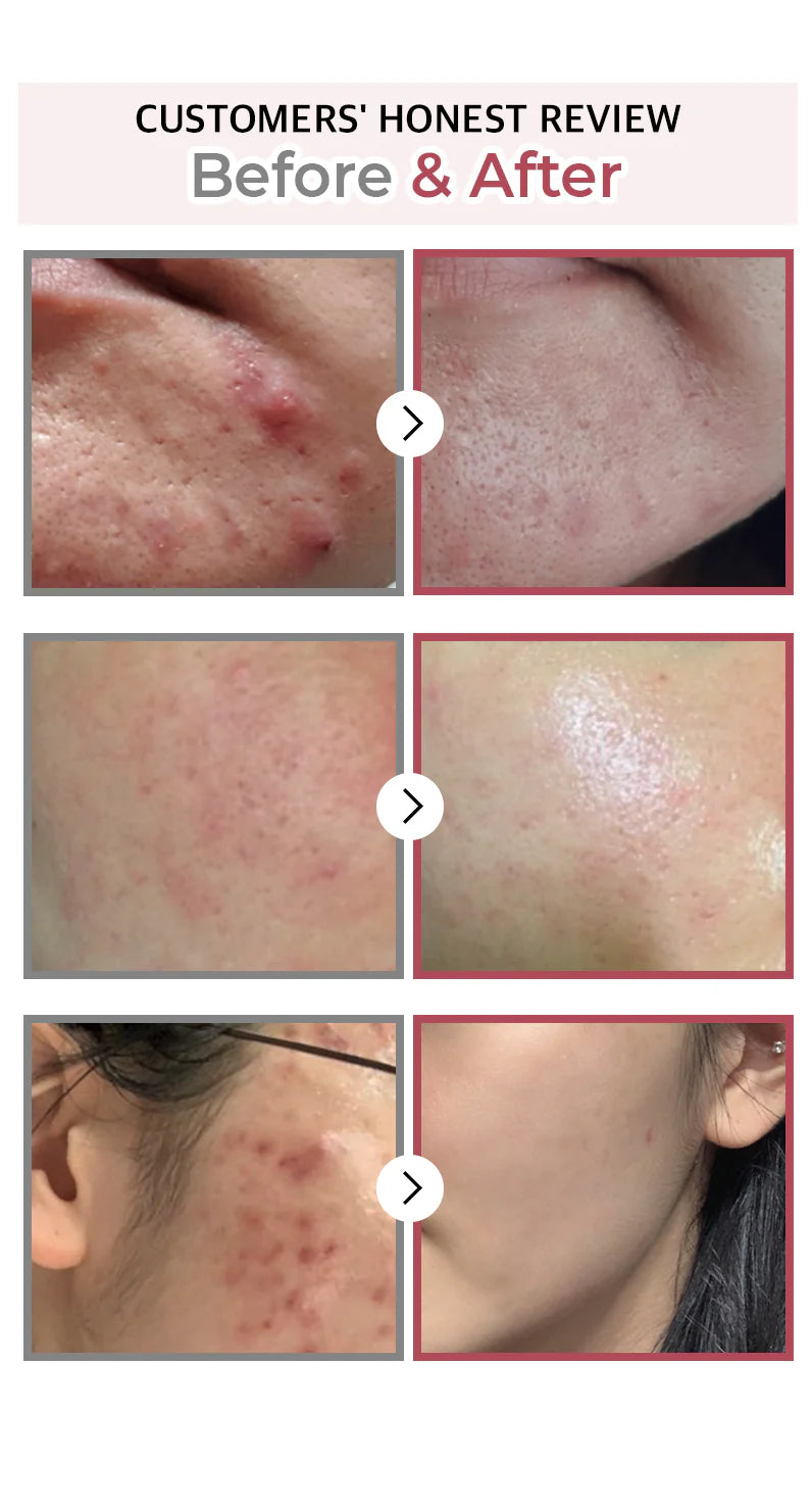 Numbuzin - No.3 Skin Softening Serum (50ml)