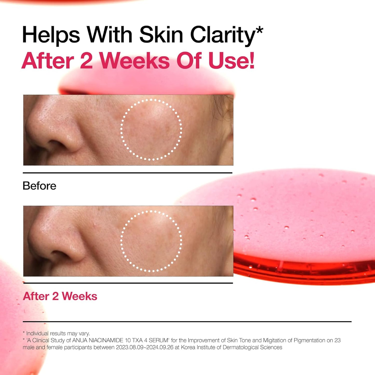 Anua - Niacinamide 10% + TXA 4% Serum (30ml)