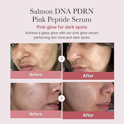 Medicube - PDRN Pink Peptide Serum (30ml)